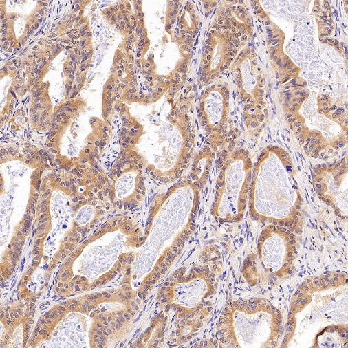 Rab5 Recombinant Rabbit mAb (S-1506-128)