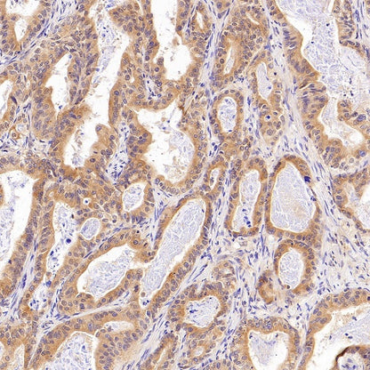 Rab5 Recombinant Rabbit mAb (S-1506-128)