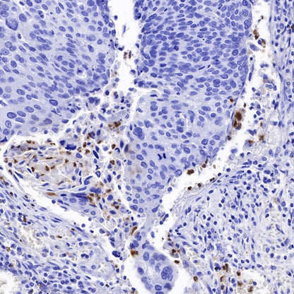 Arginase-1 Recombinant Rabbit mAb (SDT-369-33)