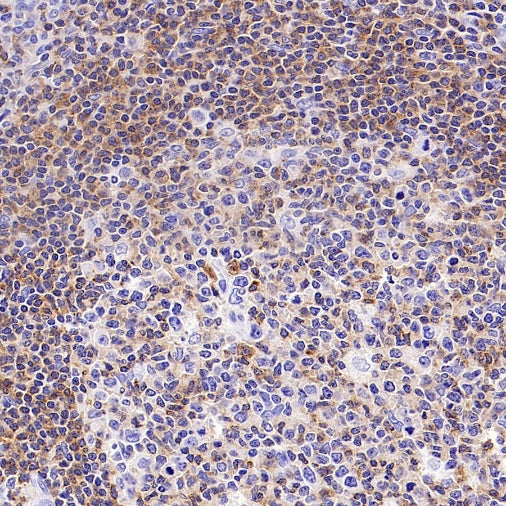 LY9/CD229 Recombinant Rabbit mAb, PBS Only (SDT-2393-47)
