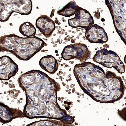 CD59 Mouse mAb (S-936-1)