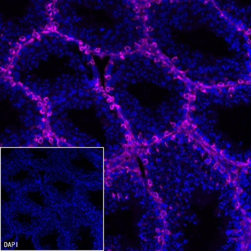 Vimentin Recombinant Rabbit mAb (Alexa Fluor® 647 Conjugate) (S-029-20)