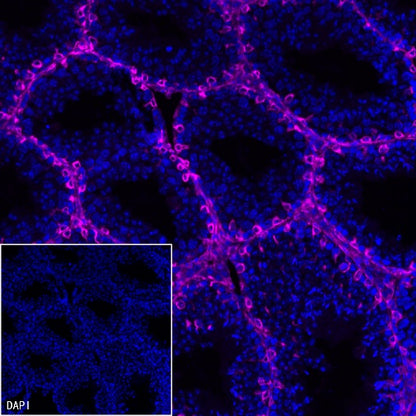 Vimentin Recombinant Rabbit mAb (Alexa Fluor® 647 Conjugate) (S-029-20)