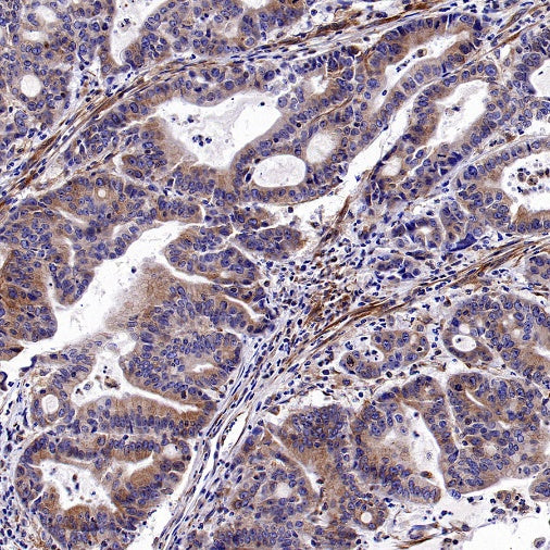 KL Recombinant Rabbit mAb (S-2245-169)
