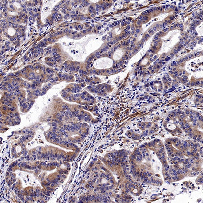 KL Recombinant Rabbit mAb (S-2245-169)