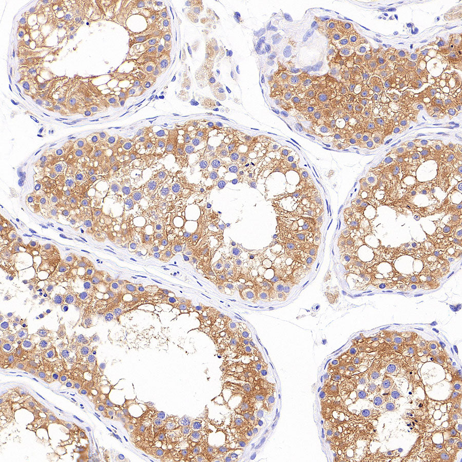 AP-2α Recombinant Rabbit mAb (S-4444-44)