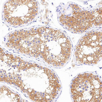 AP-2α Recombinant Rabbit mAb (S-4444-44)