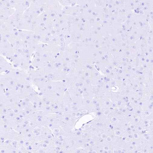 S-RMab® DAZL Recombinant Rabbit mAb (S-1588-3)