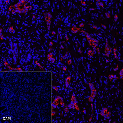 AMACR/p504s Recombinant Rabbit mAb (Alexa Fluor® 555 Conjugate) (SDT-401-29)