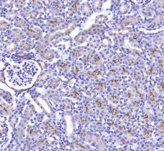 CD10 Recombinant Rabbit mAb (SDT-006-77)