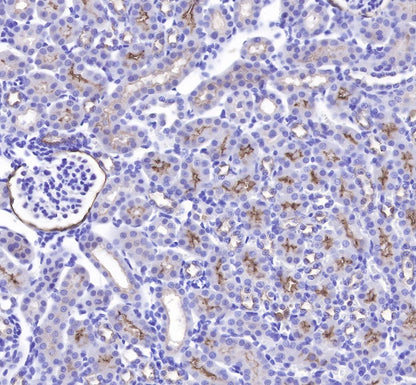 CD10 Recombinant Rabbit mAb (SDT-006-77)