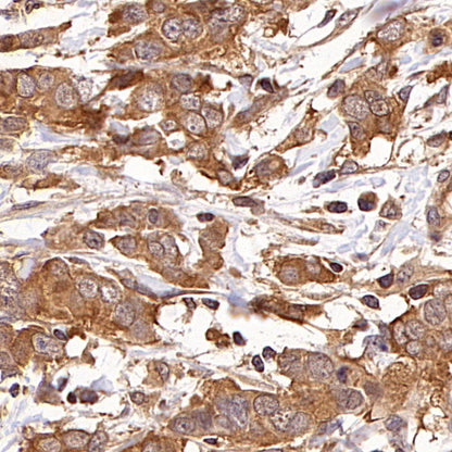 PPP2R1A Rabbit Polyclonal Antibody