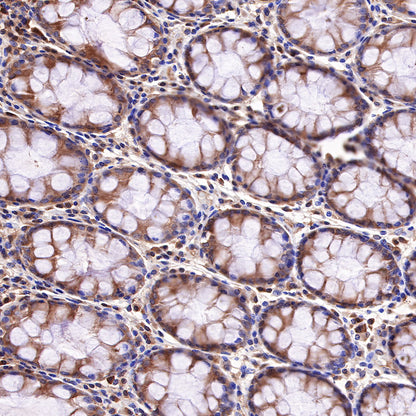 Hsp90 beta Recombinant Rabbit mAb (SDT-359-59)