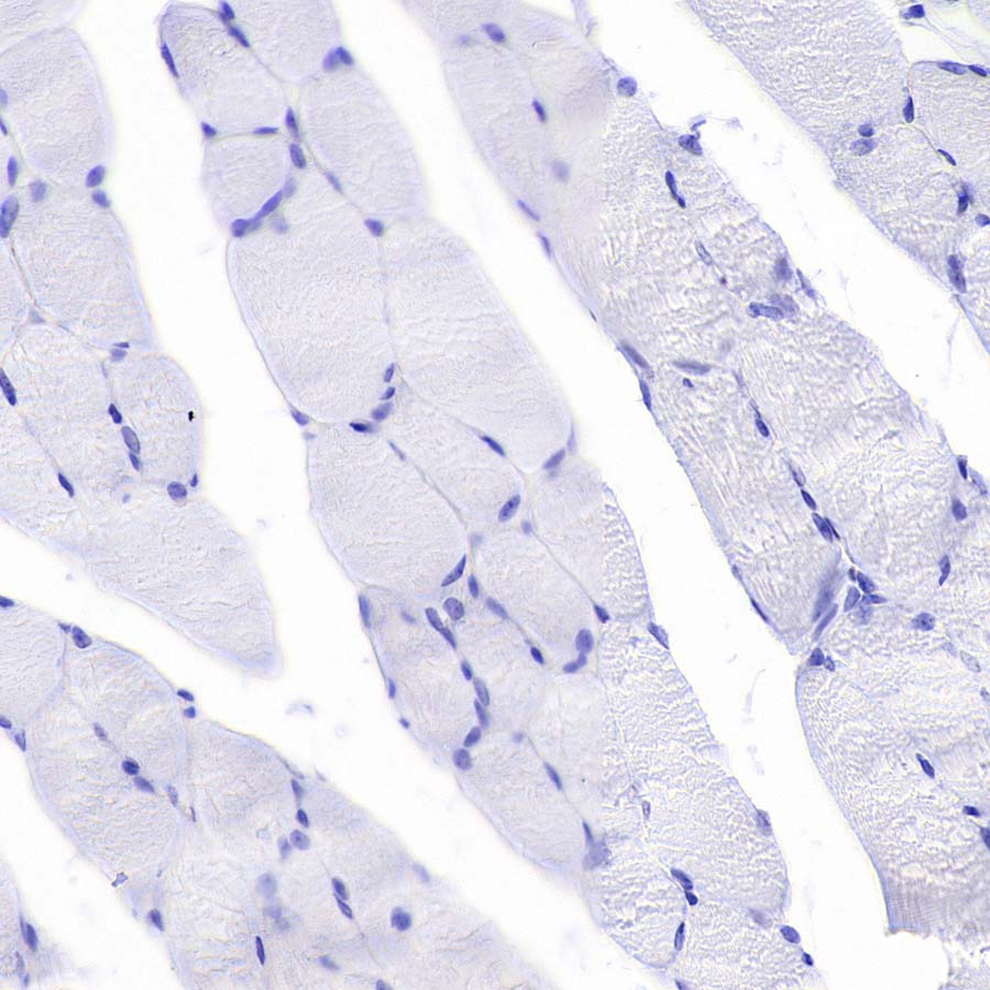 Pklr Recombinant Rabbit mAb (S-4114-40)