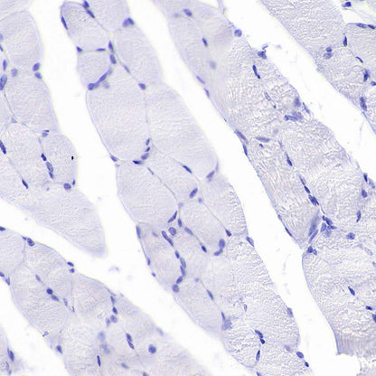 Pklr Recombinant Rabbit mAb (S-4114-40)