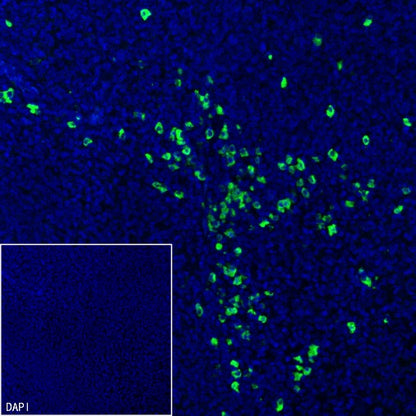 Human IgA1 Recombinant Rabbit mAb (S-2513-50)