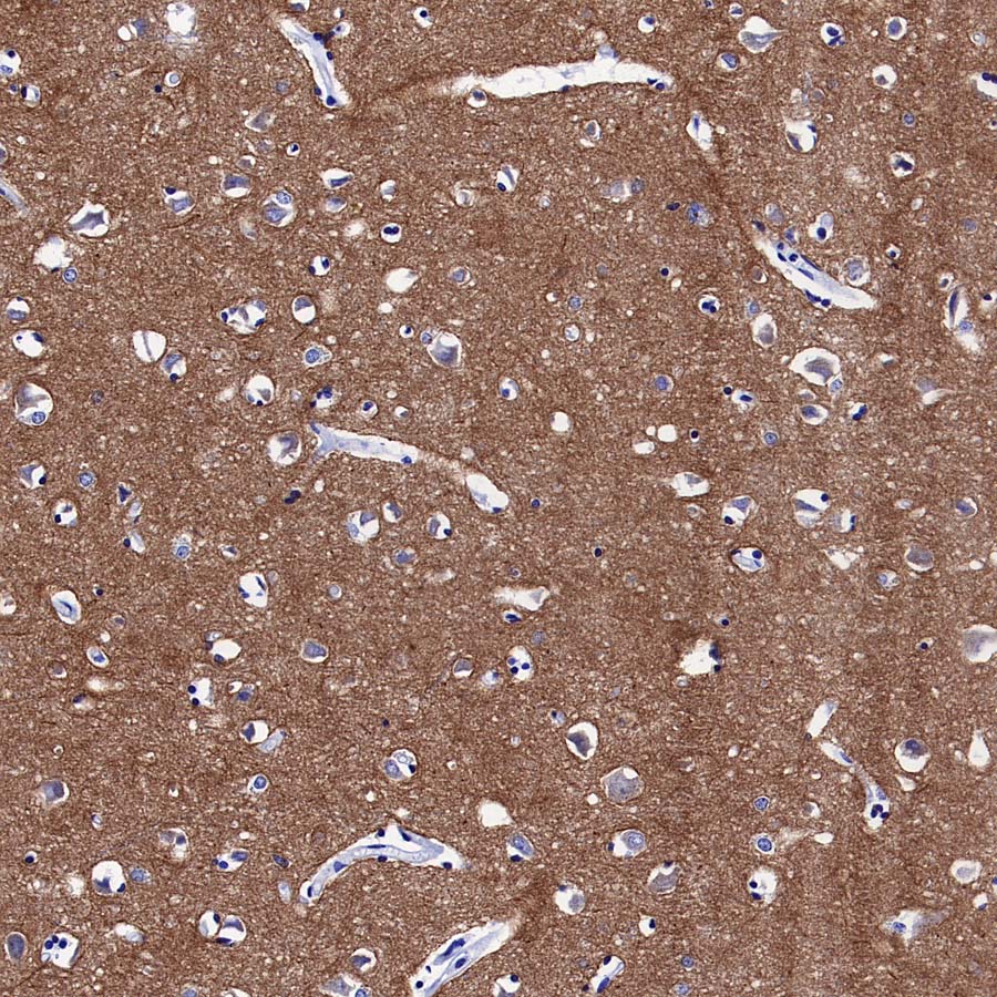 pan SCN Recombinant Rabbit mAb (S-5038)