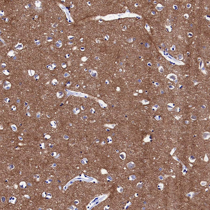 pan SCN Recombinant Rabbit mAb (S-5038)