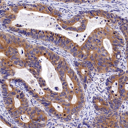 KIF5B+KIF5C Recombinant Rabbit mAb (S-2452-15)
