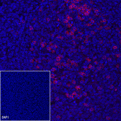 CD38 Recombinant Rabbit mAb (Alexa Fluor® 594 Conjugate) (S-031-45-2)