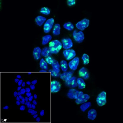 Ki67 Recombinant Rabbit mAb (Alexa Fluor® 488 Conjugate) (SDT-R459)