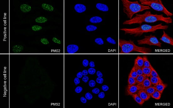 S-RMab® PMS2 Recombinant Rabbit mAb (SDT-R460)
