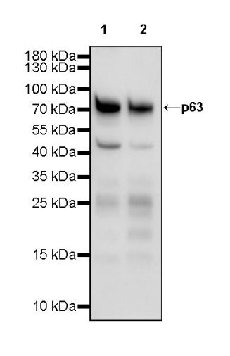 p63 Recombinant Rabbit mAb (SDT-054-137)