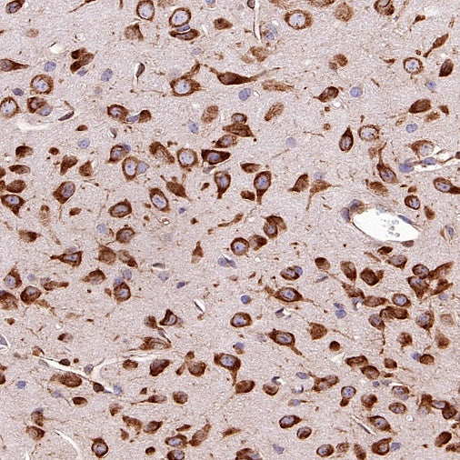 Argonaute 2 Recombinant Rabbit mAb (S-2620-13)