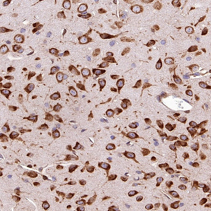 Argonaute 2 Recombinant Rabbit mAb (S-2620-13)