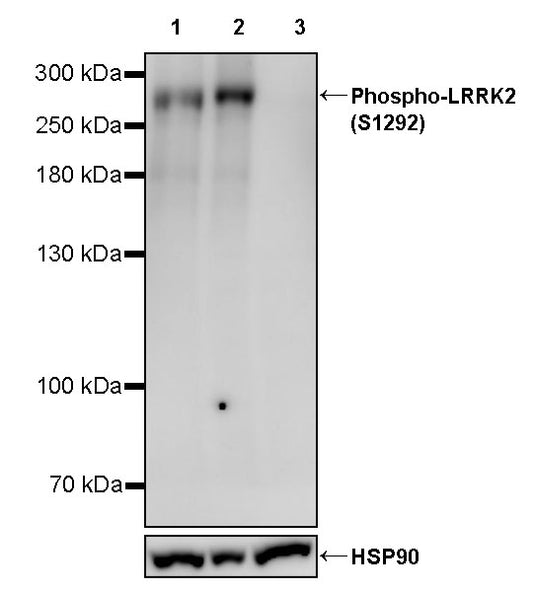 Phospho-LRRK2 (S1292) Recombinant Rabbit mAb (S-2521-13)