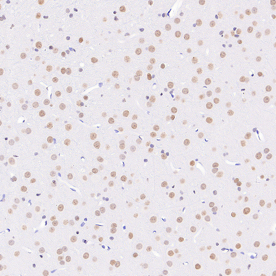 Anti-5-methylcytosine (5-mC) Recombinant Mouse mAb (S-3720)