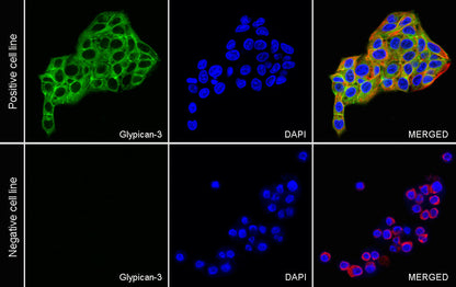 Glypican-3 Recombinant Rabbit mAb (SDT-4064-69)