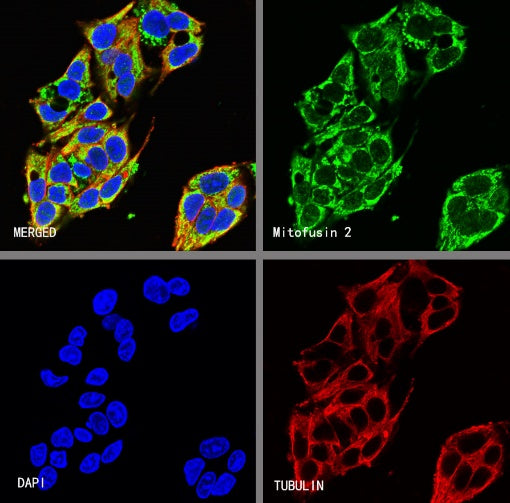 Mitofusin 2 Recombinant Rabbit mAb (S-1783-49)