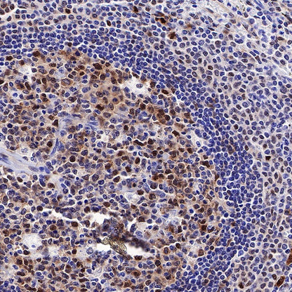 SQSTM1/p62 Recombinant Rabbit mAb (S-R346)
