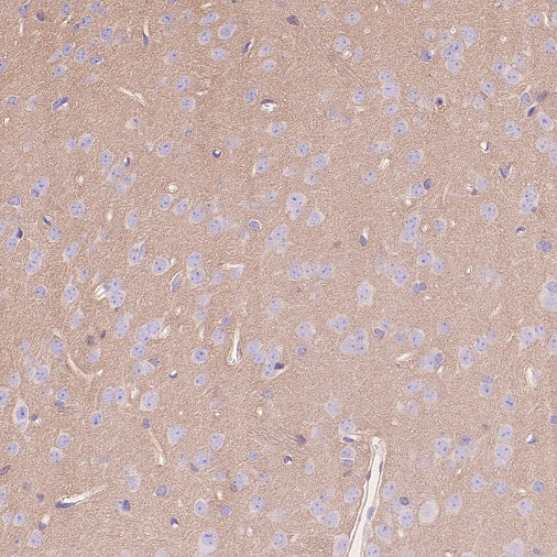 Rac1/2/3 Recombinant Rabbit mAb (S-2720-10)