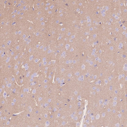 Rac1/2/3 Recombinant Rabbit mAb (S-2720-10)