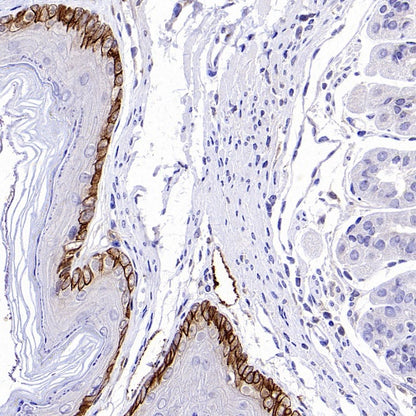 Cytokeratin 6A (KRT6A) Recombinant Mouse mAb (SDT-3380)