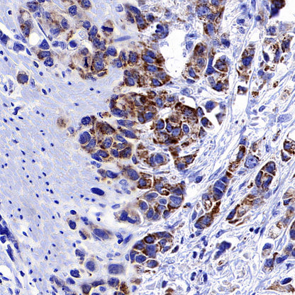 CHCHD10 Recombinant Rabbit mAb (S-4106-13)