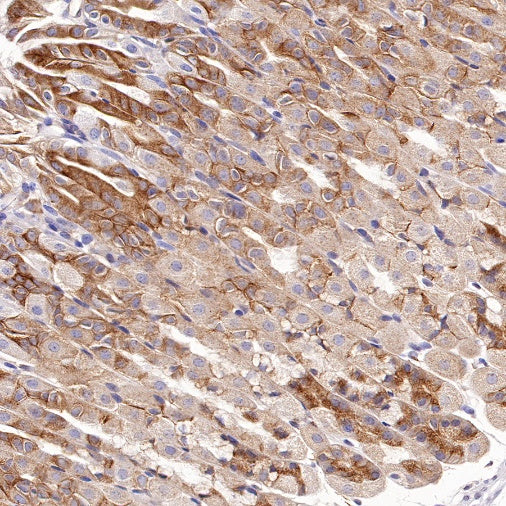VPS26 Rabbit Polyclonal Antibody