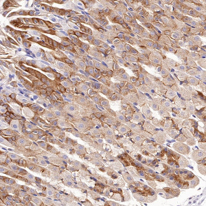 VPS26 Rabbit Polyclonal Antibody