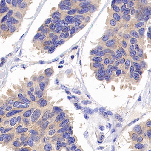 Beclin-1 Recombinant Rabbit mAb (S-761-15)