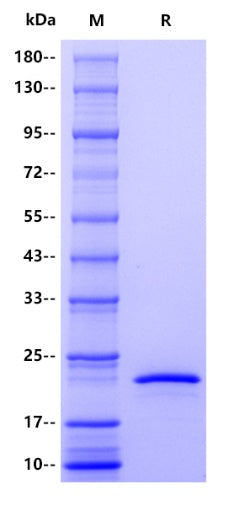 Human Occludin Protein, His tag
