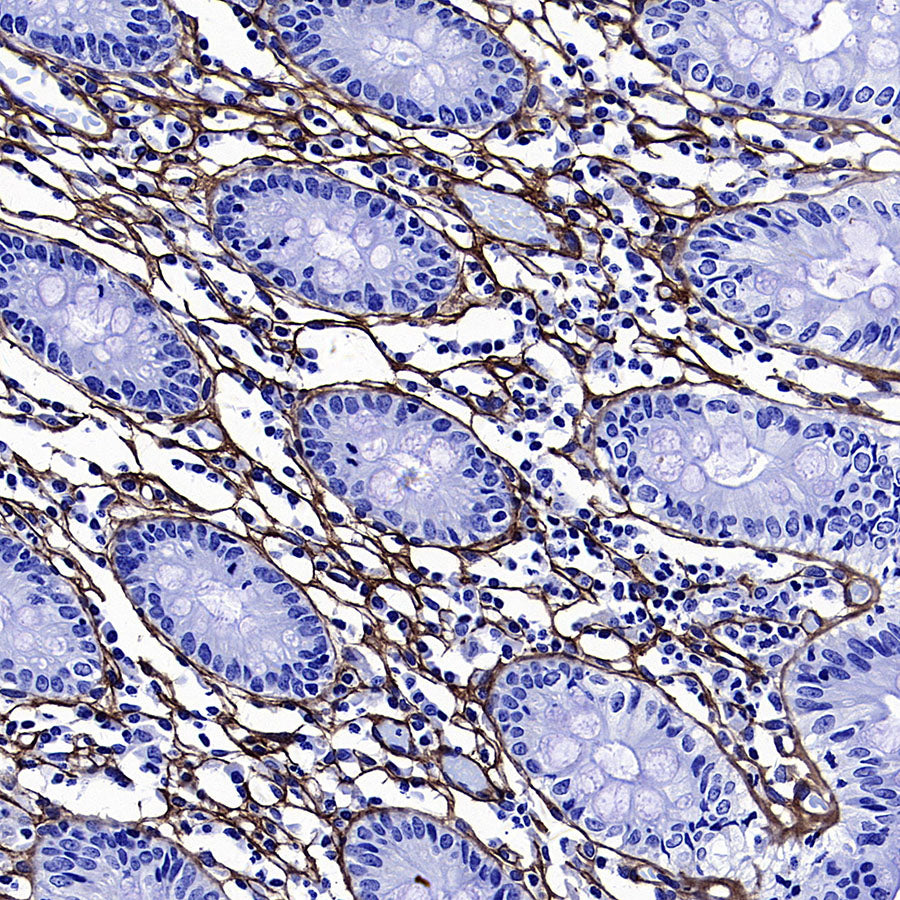COL3A1 Recombinant Rabbit mAb (S-4338)