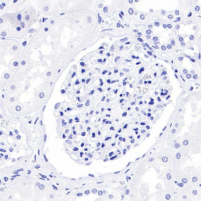 Human Growth Hormone / GH Recombinant Rabbit mAb (SDT-1160-40)
