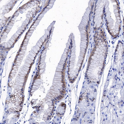 CD82 Recombinant Rabbit mAb (S-673-44)