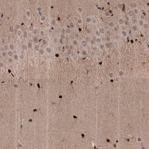 ADK Rabbit Polyclonal Antibody