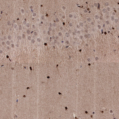 ADK Rabbit Polyclonal Antibody