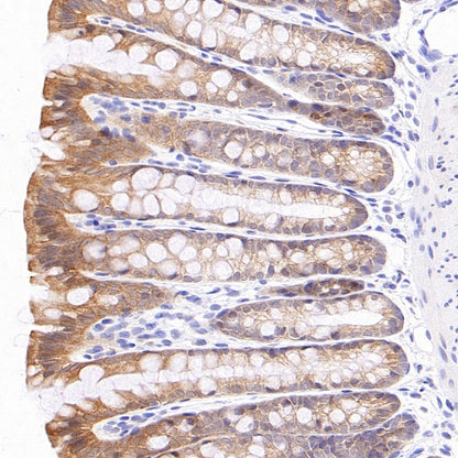 p90RSK Recombinant Rabbit mAb (S-1024-26)