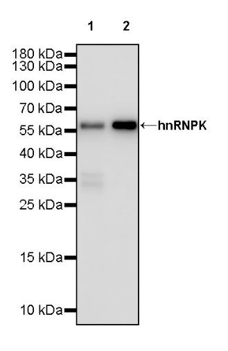 hnRNPK Recombinant Rabbit mAb (S-1645-45)