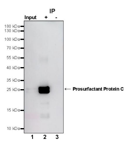 Prosurfactant Protein C Recombinant Rabbit mAb (S-1773-6)